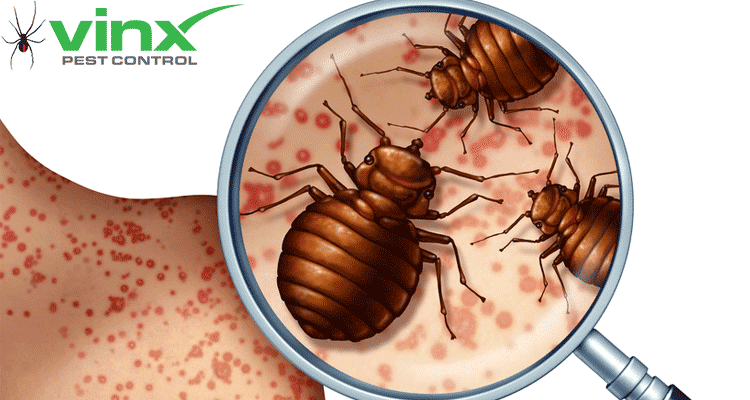 Magnifying glass over bed bugs on skin covered in red bite marks, used to identify bed bug bites