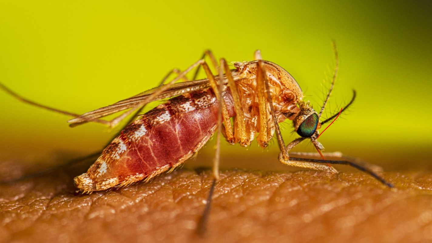 Culex mosquito feeding on skin with its abdomen swollen with blood